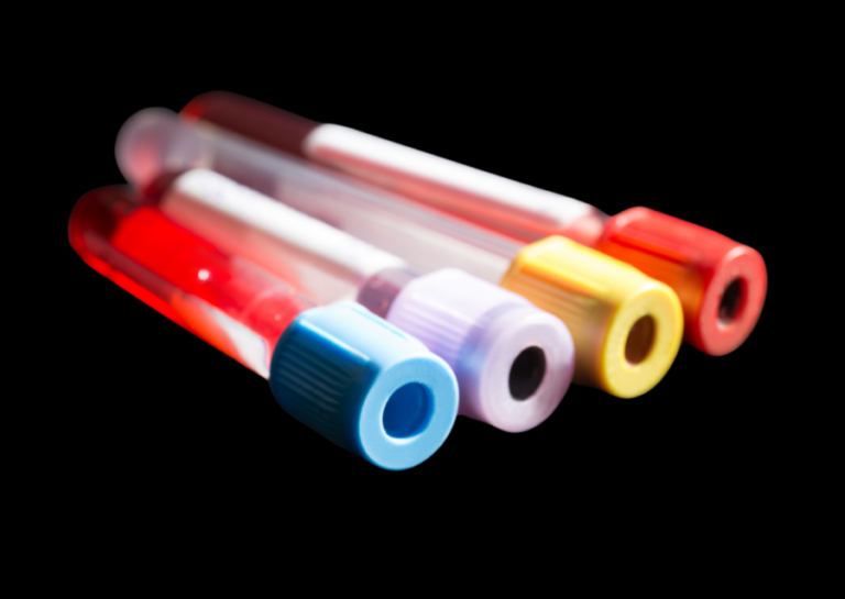 hormone and lab testing blood vial for peptide protocol evaluation