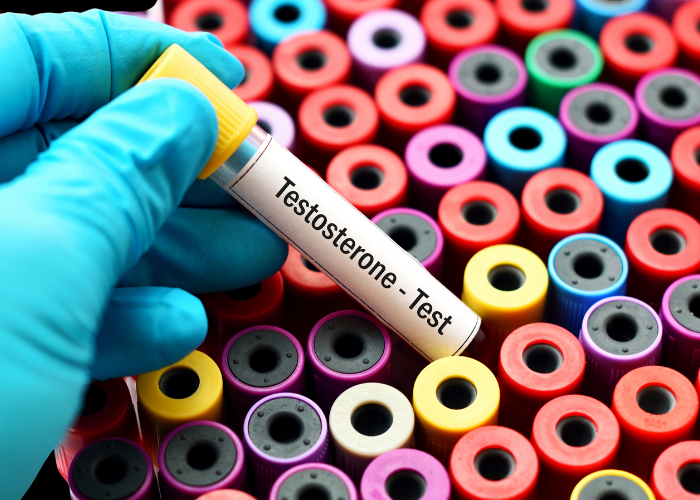 testosterone lab panel for adults over 40