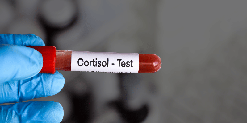 illustration of cortisol testing and hormone lab results for adults over 40