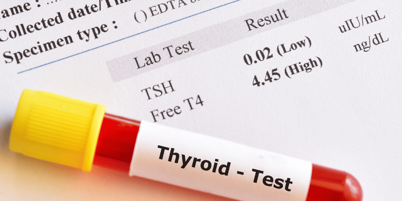 Thyroid bloodwork panel showing key markers used in thyroid optimization over 40.