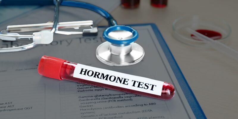 Hormone blood test vial on medical clipboard, representing lab testing used to assess hormone recovery after 40