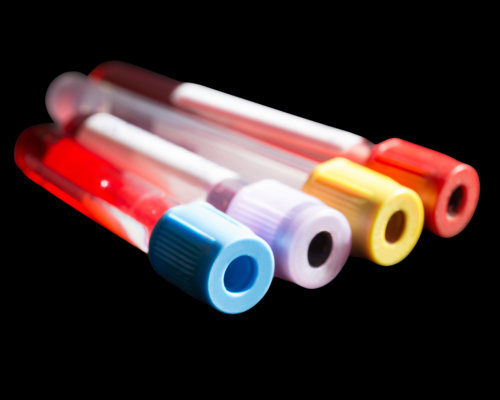 hormone and lab testing blood vial for peptide protocol evaluation